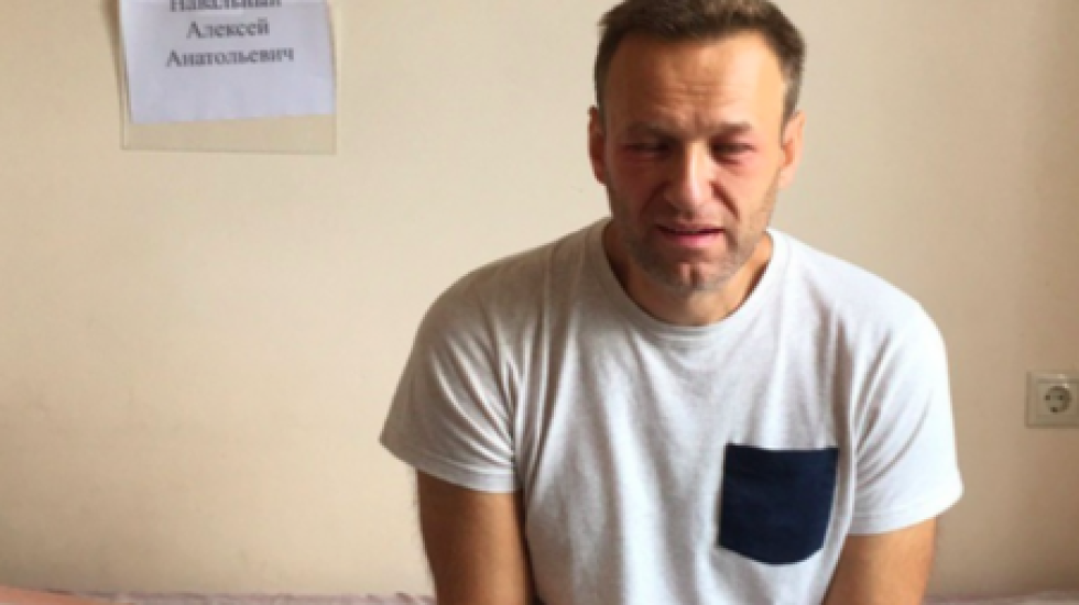 Суд отказался приостанавливать арест Навального в связи с его болезнью
